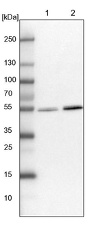 UMPS Antibody in Western Blot (WB)