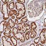 UMPS Polyclonal Antibody