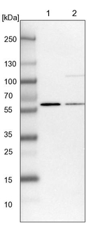 UMPS Antibody in Western Blot (WB)