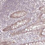 EXOSC7 Polyclonal Antibody