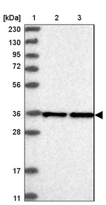 EXOSC7 Antibody in Western Blot (WB)