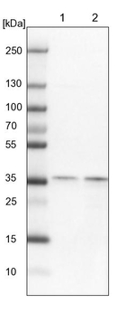 EXOSC7 Antibody in Western Blot (WB)