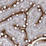 ZNF385D Polyclonal Antibody