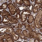 RPP14 Antibody in Immunohistochemistry (Paraffin) (IHC (P))