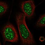 CRIP3 Polyclonal Antibody