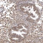 CRIP3 Antibody in Immunohistochemistry (Paraffin) (IHC (P))