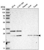 CRIP3 Antibody in Western Blot (WB)