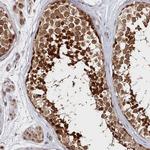 KATNA1 Antibody in Immunohistochemistry (Paraffin) (IHC (P))