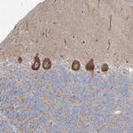 WDR49 Antibody in Immunohistochemistry (Paraffin) (IHC (P))
