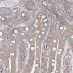 WDR49 Antibody in Immunohistochemistry (Paraffin) (IHC (P))