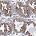 WDR49 Antibody in Immunohistochemistry (Paraffin) (IHC (P))