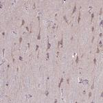 TOMM40 Antibody in Immunohistochemistry (Paraffin) (IHC (P))