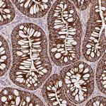 TOMM40 Antibody in Immunohistochemistry (Paraffin) (IHC (P))