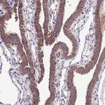 TOMM40 Antibody in Immunohistochemistry (Paraffin) (IHC (P))