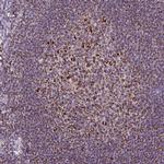 TOMM40 Antibody in Immunohistochemistry (Paraffin) (IHC (P))