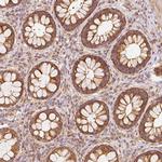 TOMM40 Antibody in Immunohistochemistry (Paraffin) (IHC (P))