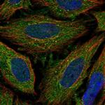 ELOVL3 Polyclonal Antibody