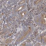 ATP11B Antibody in Immunohistochemistry (Paraffin) (IHC (P))