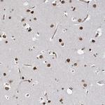 ATP11B Antibody in Immunohistochemistry (Paraffin) (IHC (P))