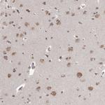 CCDC152 Antibody in Immunohistochemistry (Paraffin) (IHC (P))