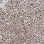 CCDC152 Antibody in Immunohistochemistry (Paraffin) (IHC (P))