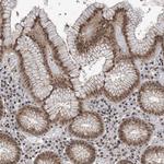 CCDC152 Antibody in Immunohistochemistry (Paraffin) (IHC (P))