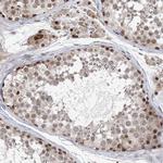 CCDC152 Antibody in Immunohistochemistry (Paraffin) (IHC (P))