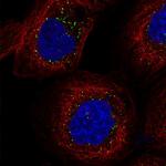 FAM98A Polyclonal Antibody