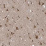 FAM98A Antibody in Immunohistochemistry (Paraffin) (IHC (P))