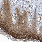 FAM98A Antibody in Immunohistochemistry (Paraffin) (IHC (P))