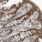 FAM98A Antibody in Immunohistochemistry (Paraffin) (IHC (P))