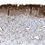 FAM98A Antibody in Immunohistochemistry (IHC)
