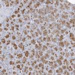 FAM98A Antibody in Immunohistochemistry (Paraffin) (IHC (P))