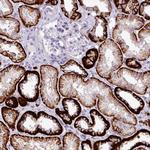 CDH16 Polyclonal Antibody