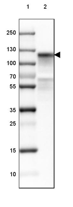 CDH16 Antibody in Western Blot (WB)