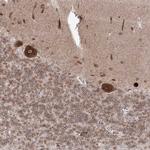 DNAJB2 Antibody in Immunohistochemistry (Paraffin) (IHC (P))