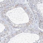 PLEKHG4B Polyclonal Antibody