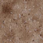 CaBP8 Polyclonal Antibody