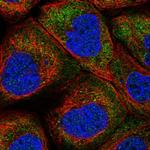 LARP2 Polyclonal Antibody