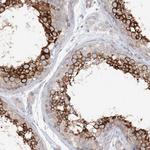 LARP2 Antibody in Immunohistochemistry (Paraffin) (IHC (P))