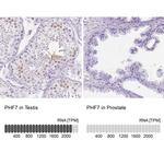 PHF7 Polyclonal Antibody