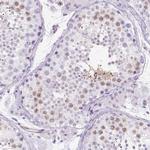 PHF7 Antibody in Immunohistochemistry (IHC)