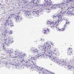 PHF7 Antibody in Immunohistochemistry (IHC)