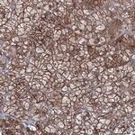 EXOC6 Polyclonal Antibody