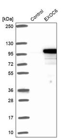 EXOC6 Antibody in Western Blot (WB)