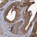 Cyclin Y Polyclonal Antibody