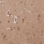 ARL3 Polyclonal Antibody