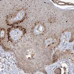 NPM3 Antibody in Immunohistochemistry (Paraffin) (IHC (P))