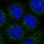 ARHGAP30 Polyclonal Antibody