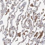 ARHGAP30 Antibody in Immunohistochemistry (Paraffin) (IHC (P))